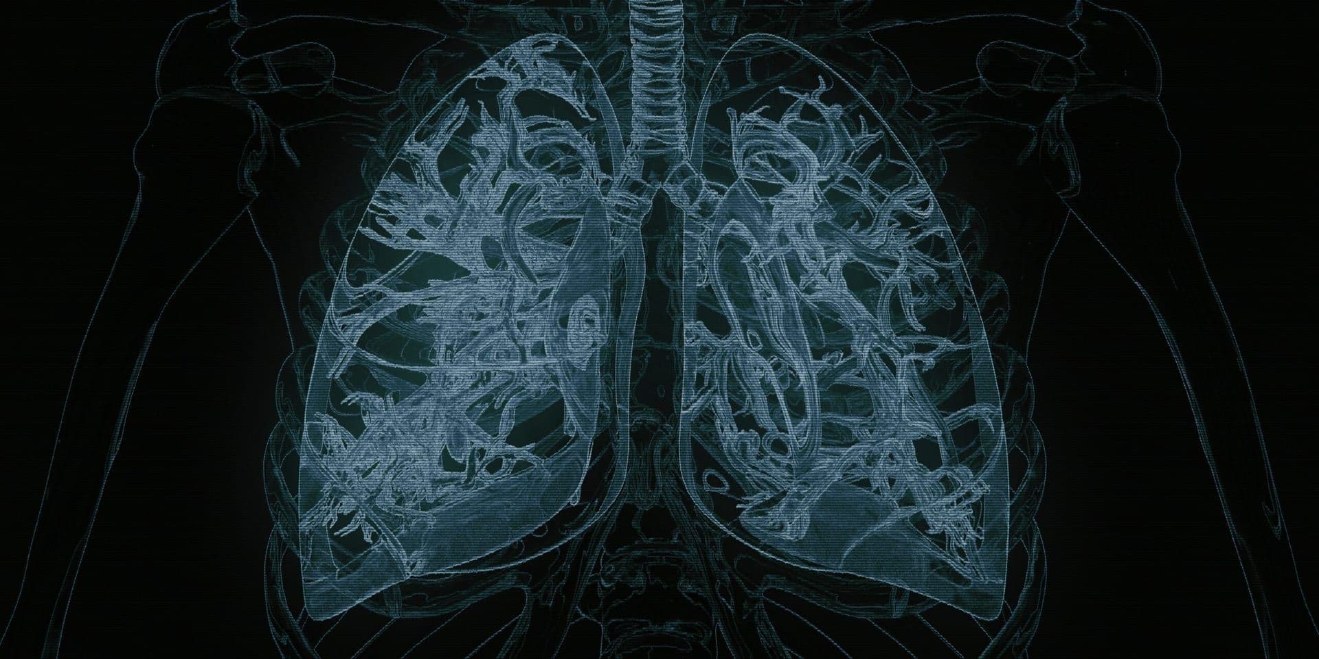 AI Tool iSeg Enhances Lung Tumor Detection, Matching and Surpassing Human Accuracy