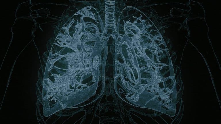 AI Tool iSeg Enhances Lung Tumor Detection, Matching and Surpassing Human Accuracy